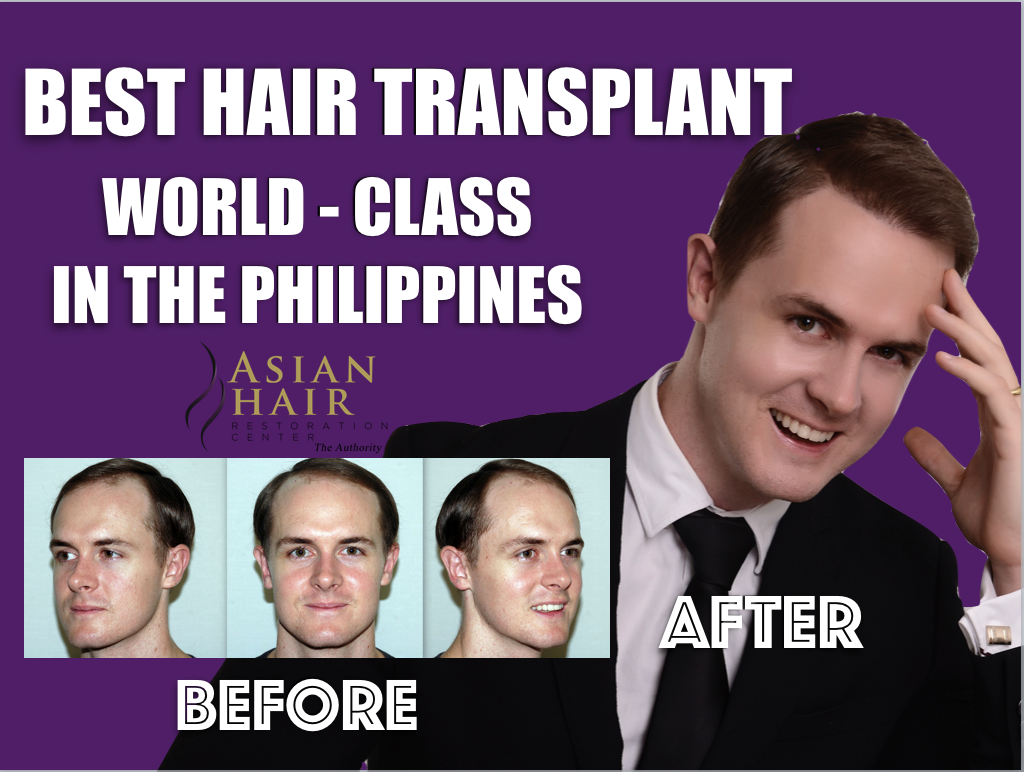 Asian Hair Restoration Center