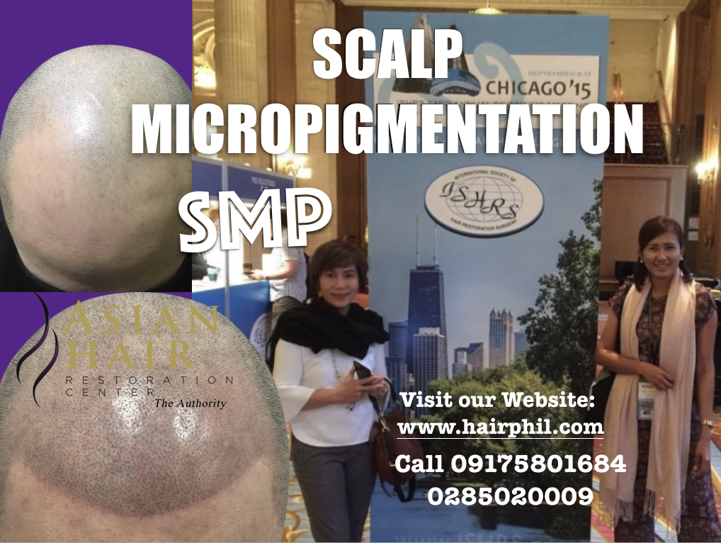 Scalp Micropigmentation Providers ,SMP doctor and Bettina Peñalosa RN